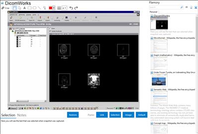 DicomWorks - Flamory bookmarks and screenshots