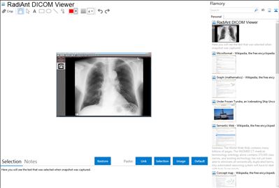 RadiAnt DICOM Viewer - Flamory bookmarks and screenshots